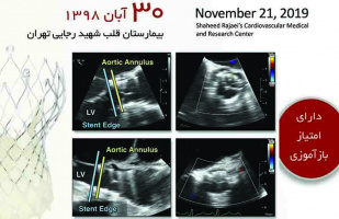 برگزاری سمپوزیوم اکوکاردیوگرافی در مرکز قلب و عروق شهید رجایی